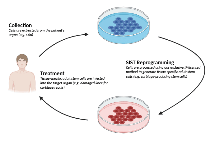 SIST Reprogramming Process