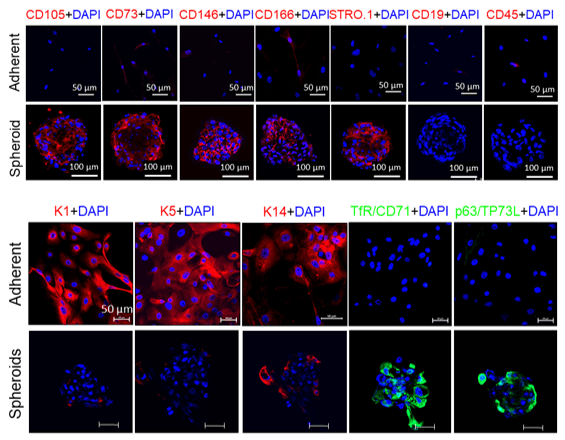 SIST-derived spheroids for wound healing