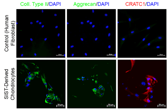 SIST-derived Chondrocytes - Immunostaining