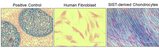 SIST-derived Chondrocytes - Alcian blue staining